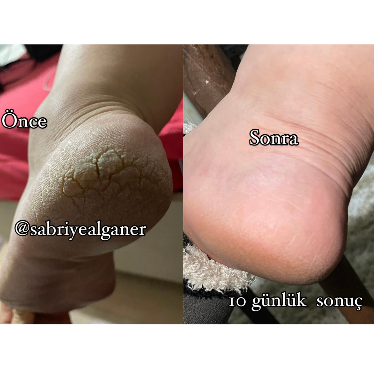 Sabral Topuk Onarıcı Bakım Yağı (Topuk • El • Ayak • Dirsek Bakımı ) 50 ml