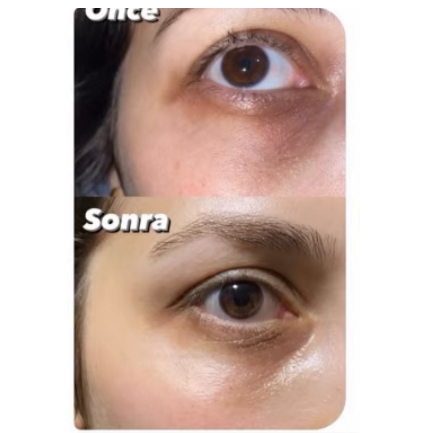 Sabral Göz Altı & Morluk Karşıtı Set