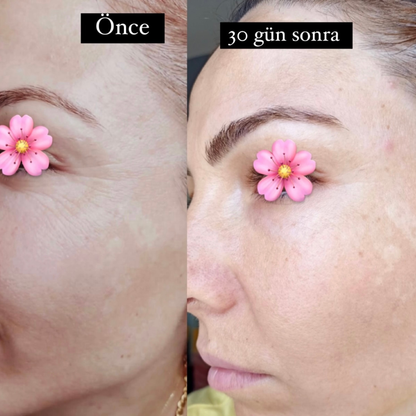 Sabral Botoks Etkili Anti-Aging Set