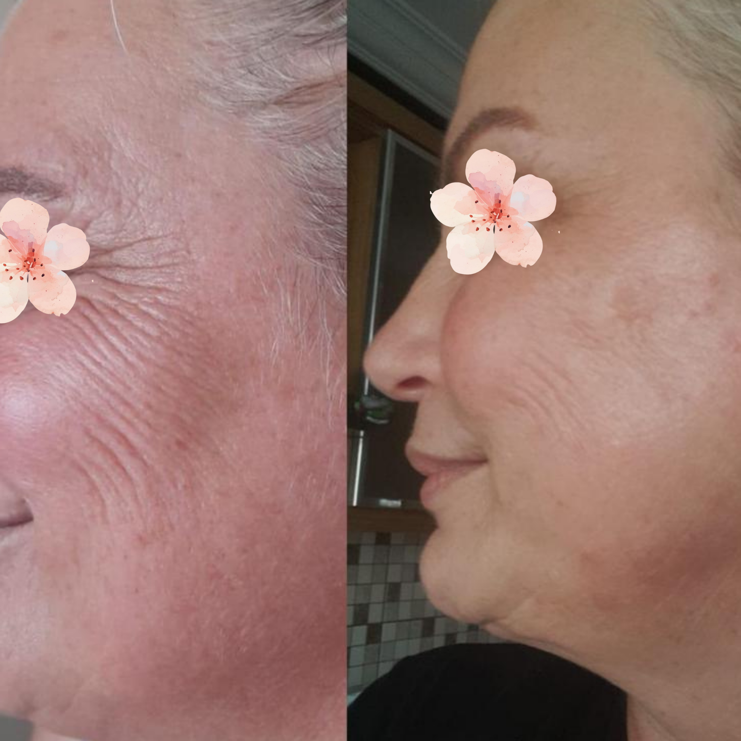 Sabral Botoks Etkili Anti-Aging Set