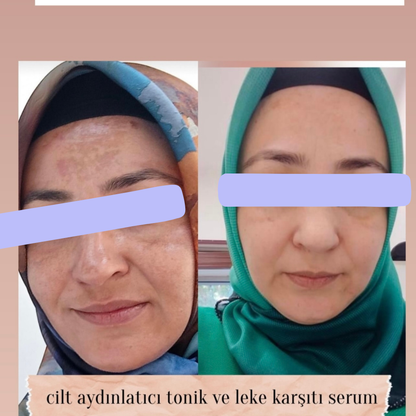 Sabral Leke Karşıtı Aydınlatıcı Set