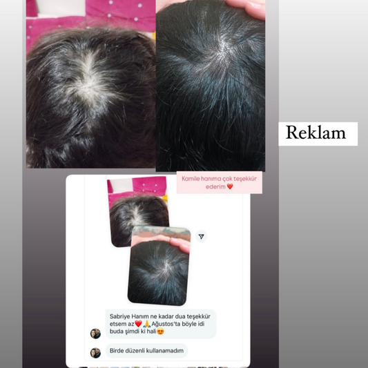 Sabral Saç Kökü Güçlendirici & Besleyici Serum 50ml (Dökülme Karşıtı • Uzamayı Destekleyen Doğal Bakım)