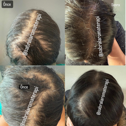 Sabral Saç Bakım Seti (Dökülme Karşıtı Yeni Saç Oluşumu Destekleyici)