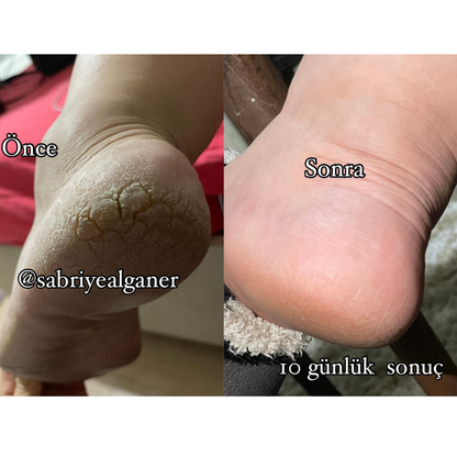 Sabral Topuk Onarıcı Bakım Yağı  (Topuk • El • Ayak • Dirsek Bakımı ) 50 ml